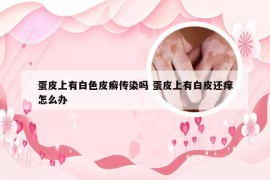 蛋皮上有白色皮癣传染吗 蛋皮上有白皮还痒怎么办