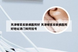 天津哪家皮肤病医院好 天津哪家皮肤病医院好地址津门如何挂号