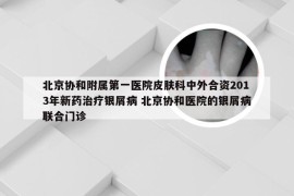 北京协和附属第一医院皮肤科中外合资2013年新药治疗银屑病 北京协和医院的银屑病联合门诊
