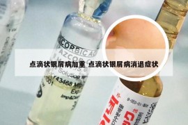 点滴状银屑病加重 点滴状银屑病消退症状