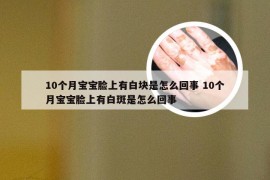 10个月宝宝脸上有白块是怎么回事 10个月宝宝脸上有白斑是怎么回事
