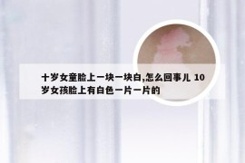 十岁女童脸上一块一块白,怎么回事儿 10岁女孩脸上有白色一片一片的