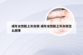 成年女性脸上长白斑 成年女性脸上长白斑怎么回事