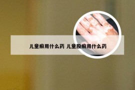儿童癣用什么药 儿童股癣用什么药