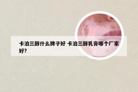 卡泊三醇什么牌子好 卡泊三醇乳膏哪个厂家好?