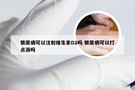 银屑病可以注射维生素D2吗 银屑病可以打点滴吗
