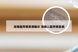 湘雅医院银屑病确诊 湘雅二医院银屑病