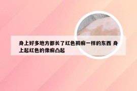 身上好多地方都长了红色褥癣一样的东西 身上起红色的像癣凸起