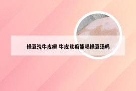 绿豆洗牛皮癣 牛皮肤癣能喝绿豆汤吗