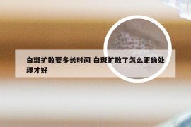 白斑扩散要多长时间 白斑扩散了怎么正确处理才好