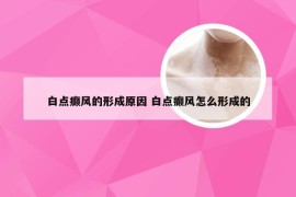 白点癫风的形成原因 白点癫风怎么形成的