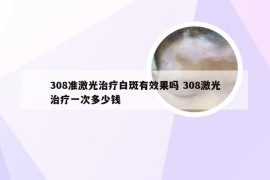 308准激光治疗白斑有效果吗 308激光治疗一次多少钱