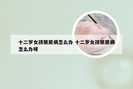 十二岁女孩银屑病怎么办 十二岁女孩银屑病怎么办呀