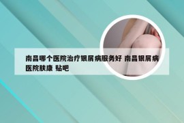 南昌哪个医院治疗银屑病服务好 南昌银屑病医院肤康 贴吧