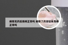 癣擦完药后很痒正常吗 癣擦了药膏轻微发痒正常吗