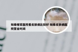 如皋哪家医院看皮肤病比较好 如皋皮肤病医院营业时间