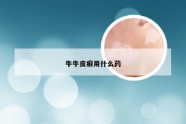 牛牛皮癣用什么药