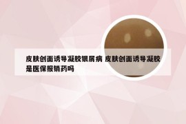 皮肤创面诱导凝胶银屑病 皮肤创面诱导凝胶是医保报销药吗