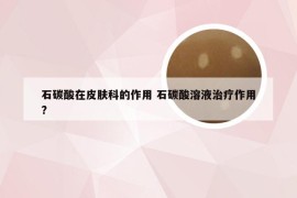 石碳酸在皮肤科的作用 石碳酸溶液治疗作用?