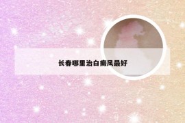 长春哪里治白癜风最好