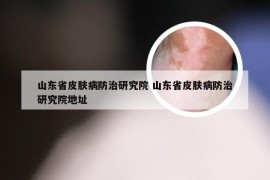 山东省皮肤病防治研究院 山东省皮肤病防治研究院地址