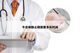 牛皮癣静止期需要多长时间