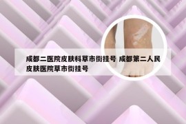 成都二医院皮肤科草市街挂号 成都第二人民皮肤医院草市街挂号