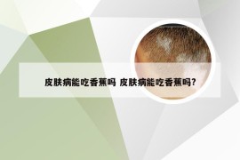 皮肤病能吃香蕉吗 皮肤病能吃香蕉吗?