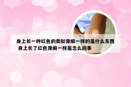 身上长一种红色的类似像癣一样的是什么东西 身上长了红色像癣一样是怎么回事
