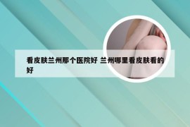 看皮肤兰州那个医院好 兰州哪里看皮肤看的好