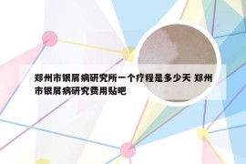 郑州市银屑病研究所一个疗程是多少天 郑州市银屑病研究费用贴吧