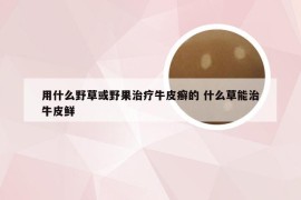 用什么野草或野果治疗牛皮癣的 什么草能治牛皮鲜