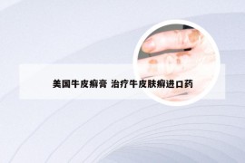 美国牛皮癣膏 治疗牛皮肤癣进口药