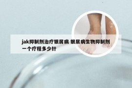 jak抑制剂治疗银屑病 银屑病生物抑制剂一个疗程多少针