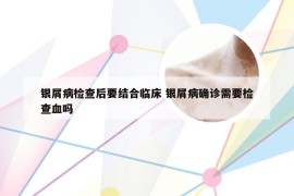 银屑病检查后要结合临床 银屑病确诊需要检查血吗