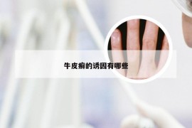 牛皮癣的诱因有哪些
