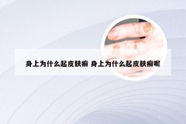 身上为什么起皮肤癣 身上为什么起皮肤癣呢