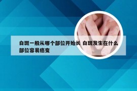白斑一般从哪个部位开始长 白斑发生在什么部位容易癌变