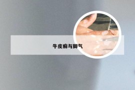 牛皮癣与脚气