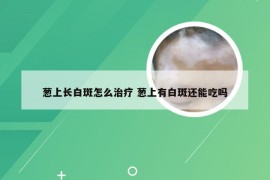 葱上长白斑怎么治疗 葱上有白斑还能吃吗