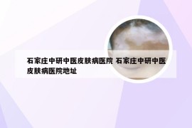 石家庄中研中医皮肤病医院 石家庄中研中医皮肤病医院地址