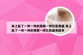 身上起了一块一块的像癣一样红色很痛 身上起了一块一块的像癣一样红色越来越多