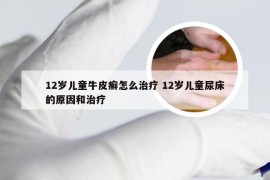12岁儿童牛皮癣怎么治疗 12岁儿童尿床的原因和治疗