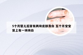 5个月婴儿后背有两块皮肤发白 五个月宝宝背上有一块块白