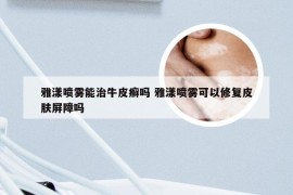 雅漾喷雾能治牛皮癣吗 雅漾喷雾可以修复皮肤屏障吗