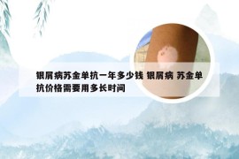银屑病苏金单抗一年多少钱 银屑病 苏金单抗价格需要用多长时间