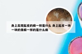 身上出现起皮的癣一样是什么 身上起皮一块一块的像癣一样的是什么癣