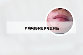 白癜风能不能多吃蛋制品
