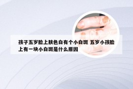 孩子五岁脸上肤色白有个小白斑 五岁小孩脸上有一块小白斑是什么原因