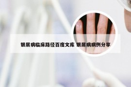 银屑病临床路径百度文库 银屑病病例分享